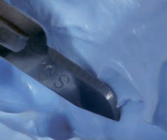 Luxatemp PLUS - надрез на оттиске